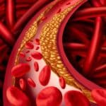 coo-aspect-ratio-535-375