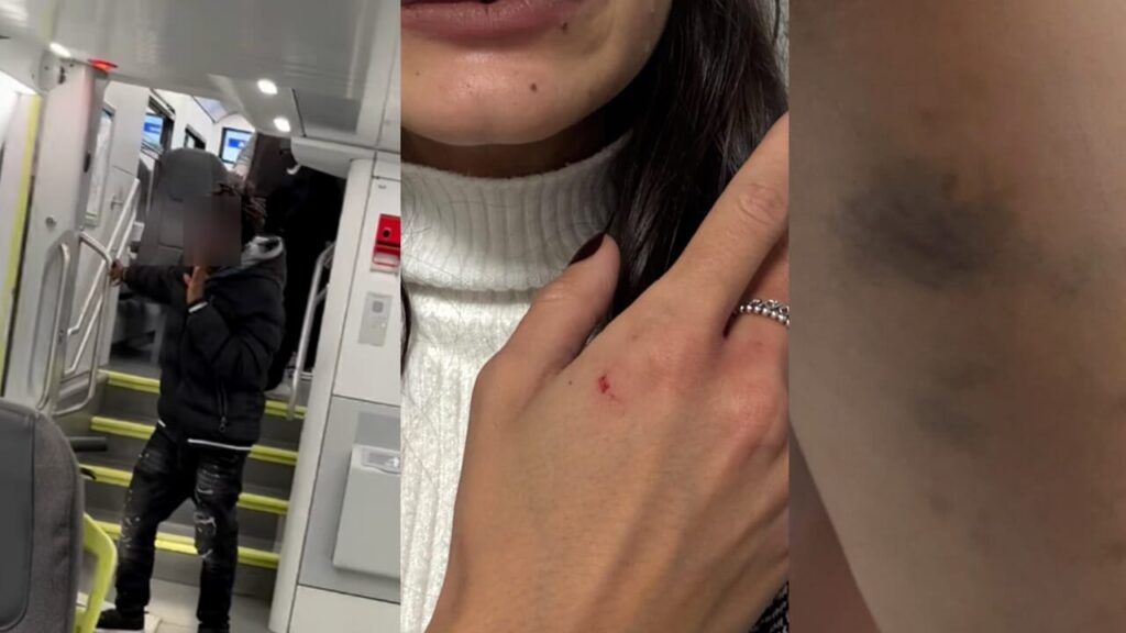 Monza, modella aggredita sul treno: “Io come la ragazza della metro di New York”