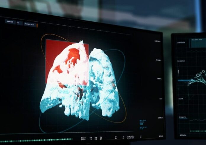 nodulo-aspect-ratio-535-375